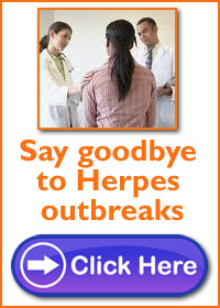 How To Heal Herpes Outbreak Naturally : Guidelines On A Brand New Technique To Live - Eat Healthy Be Wholesome